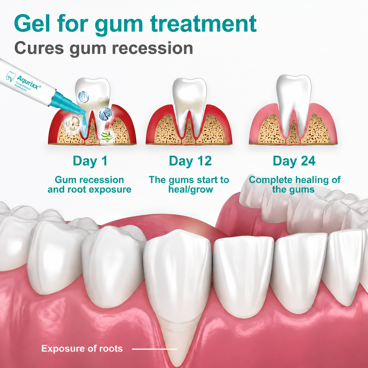 Aqurixx® Gum Protect Repair Gel